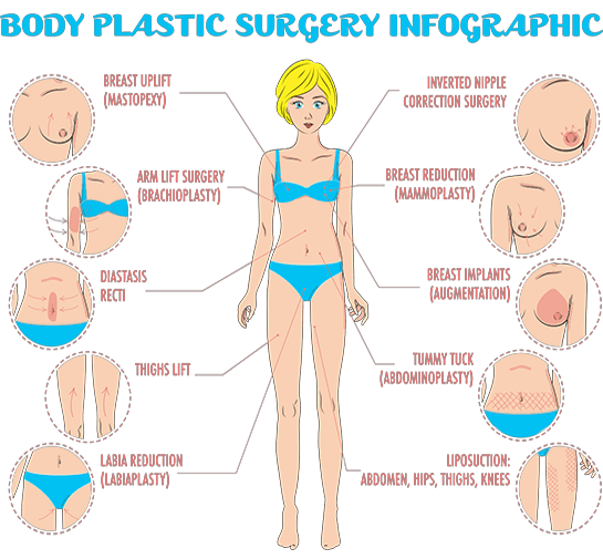 Plastic surgery infographic depicting a person's body with annotations.