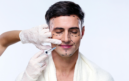 A man with lines drawn on his face for a plastic surgery procedure.