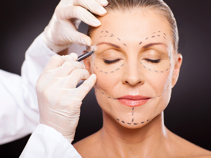 Most Common Plastic Surgery Procedures for Women