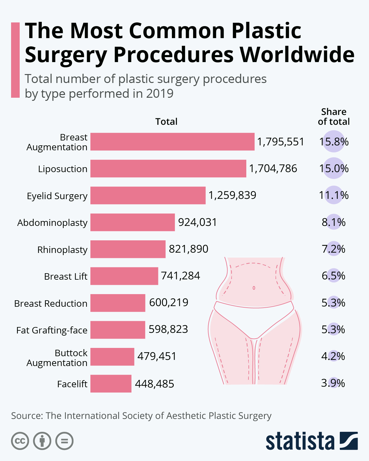 A graph of the most common plastic surgery procedures worldwide.